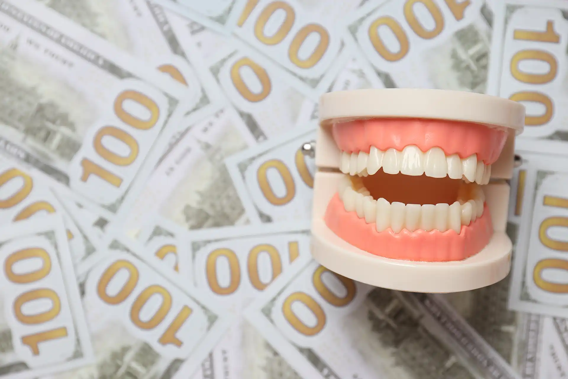 Hollywood smile makeover price in Turkey