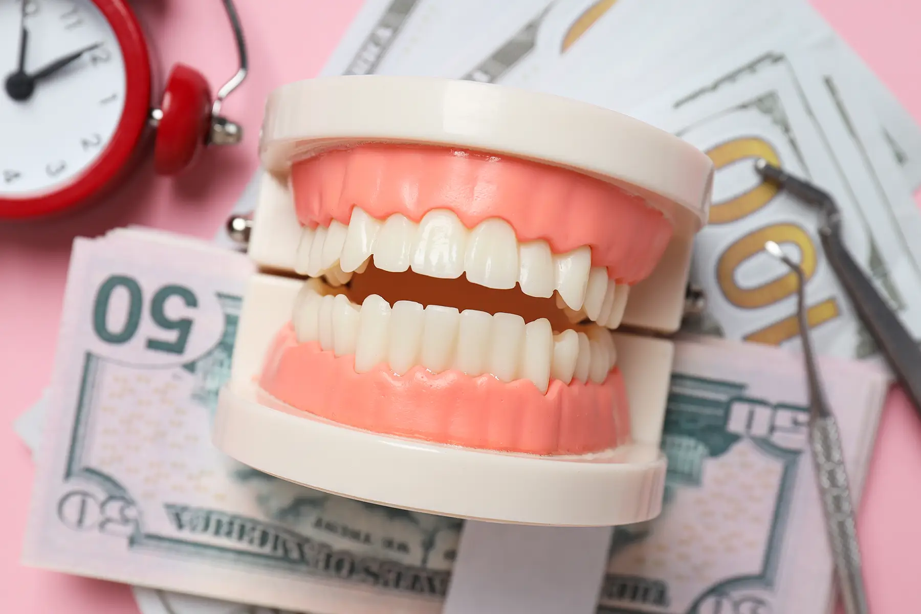 Dental implant cost in Turkey