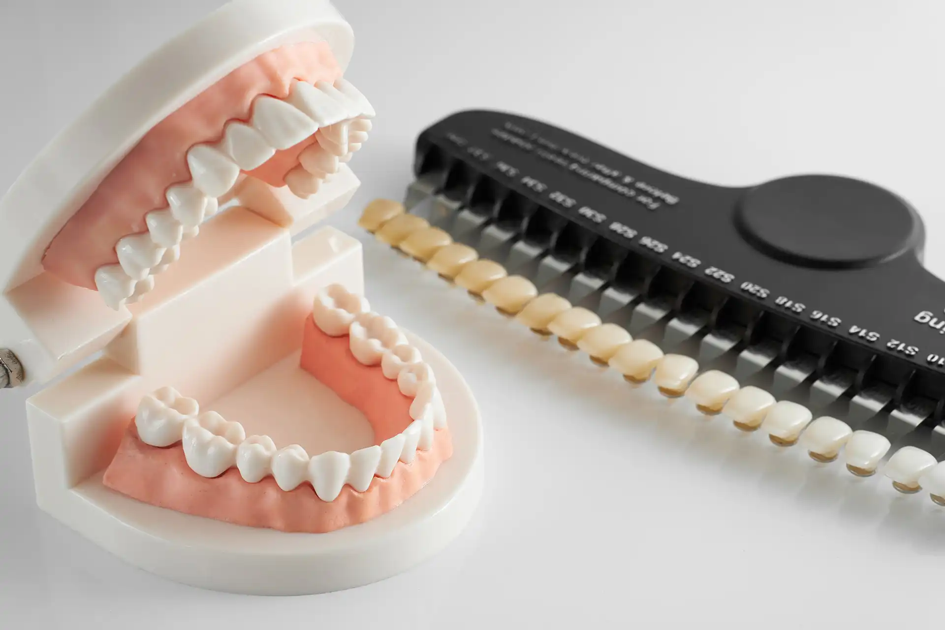 Porcelain Veneers in Turkey: The Ultimate Guide