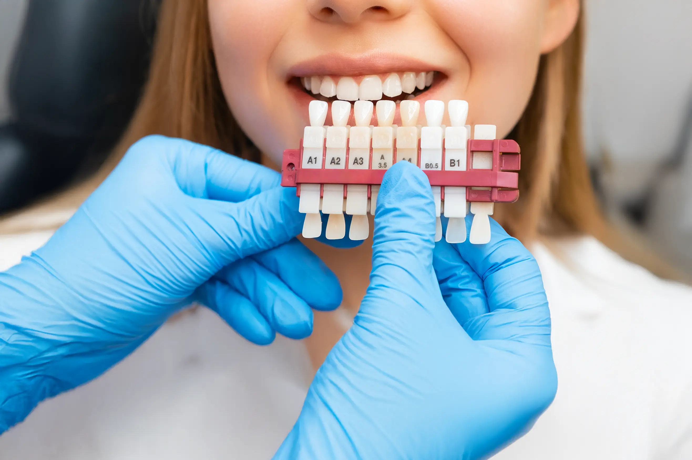 Veneers vs. Lumineers: Which One Is Right for You?