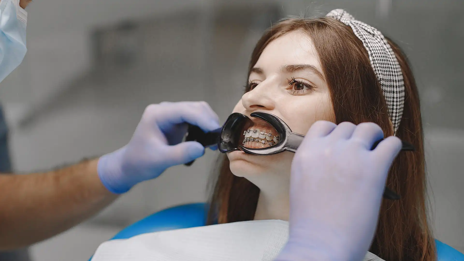 Can You Get Veneers Without Shaving Your Teeth?