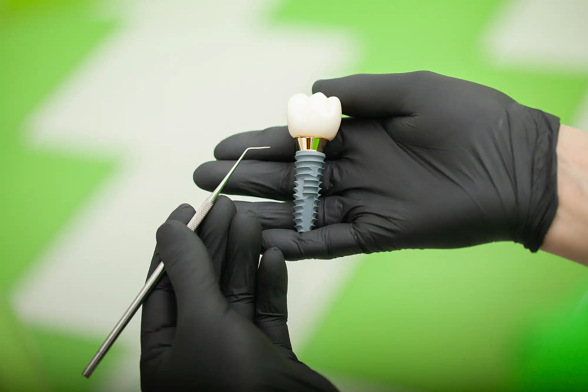 Implants vs. Dentures: Pros, Cons & Costs in Turkey