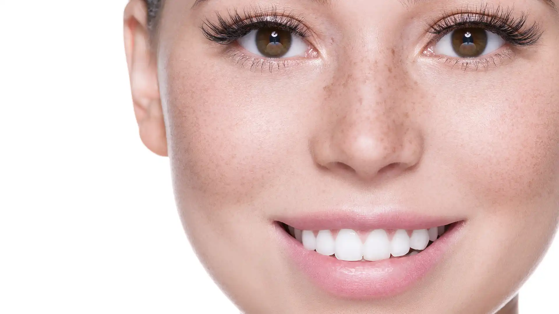 Hollywood Smile Makeover in Turkey for Russians in the EU & America – Prices, Reviews, and Complete Guide