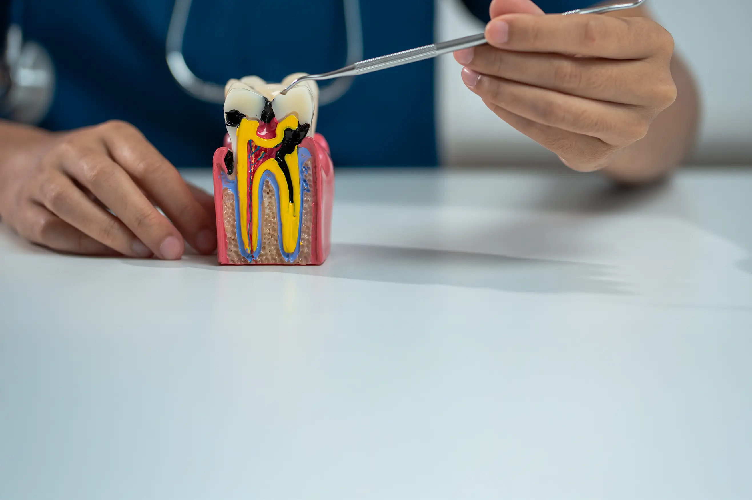 Everything You Need to Know About Root Canal Treatment: Cost, Pain, Recovery & Prevention | Background Image Everything You Need to Know About Root Canal Treatment: Cost, Pain, Recovery & Prevention | Background Image