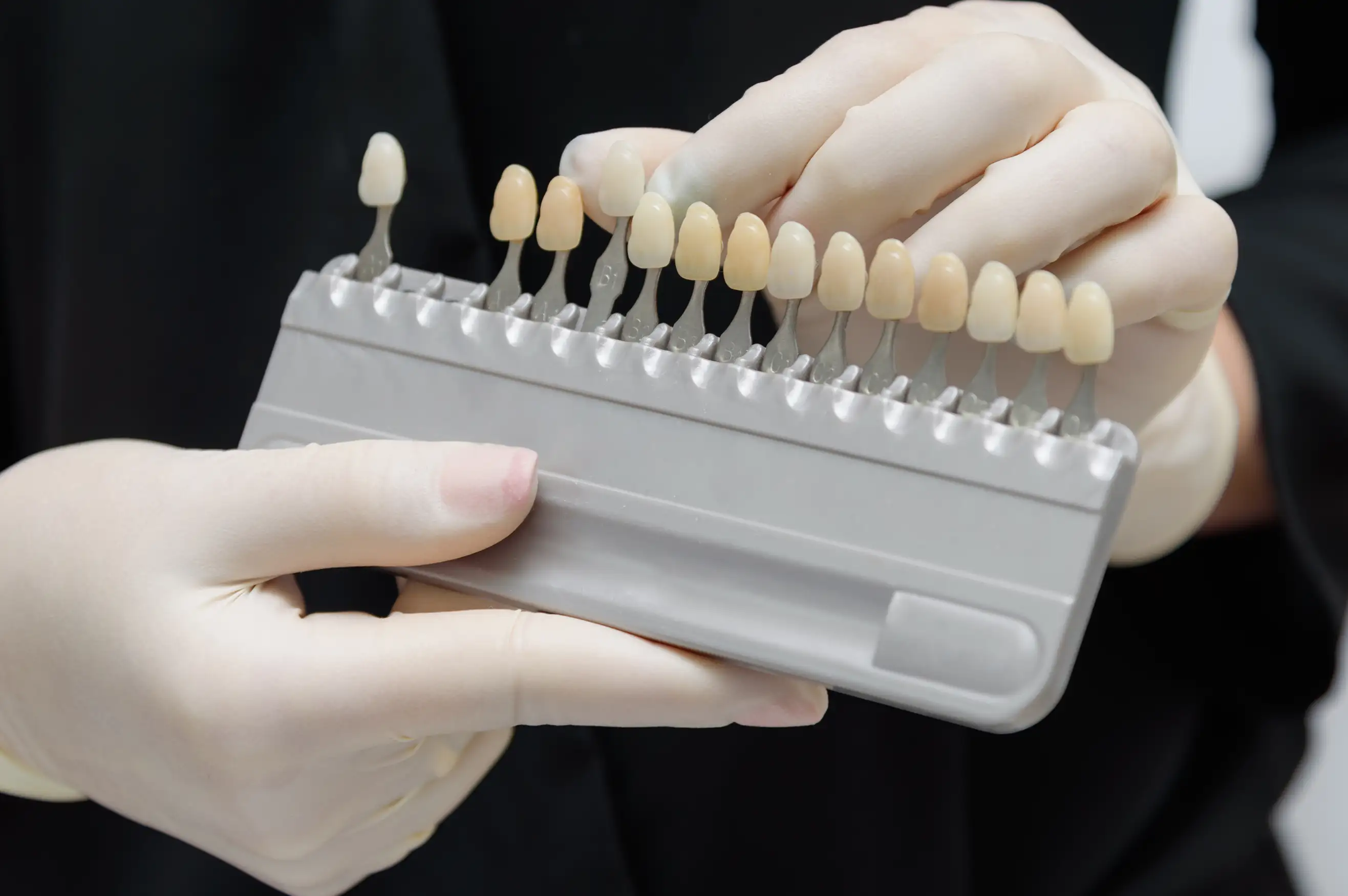 Everything You Need to Know About Dental Veneers | Background Image Everything You Need to Know About Dental Veneers | Background Image