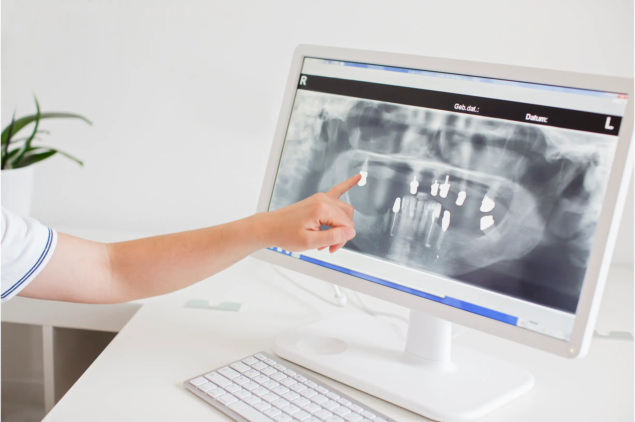 Panoramic Dental X-Ray in Turkey: Cost, Safety, and Complete Guide for Patients | Background Image Panoramic Dental X-Ray in Turkey: Cost, Safety, and Complete Guide for Patients | Background Image