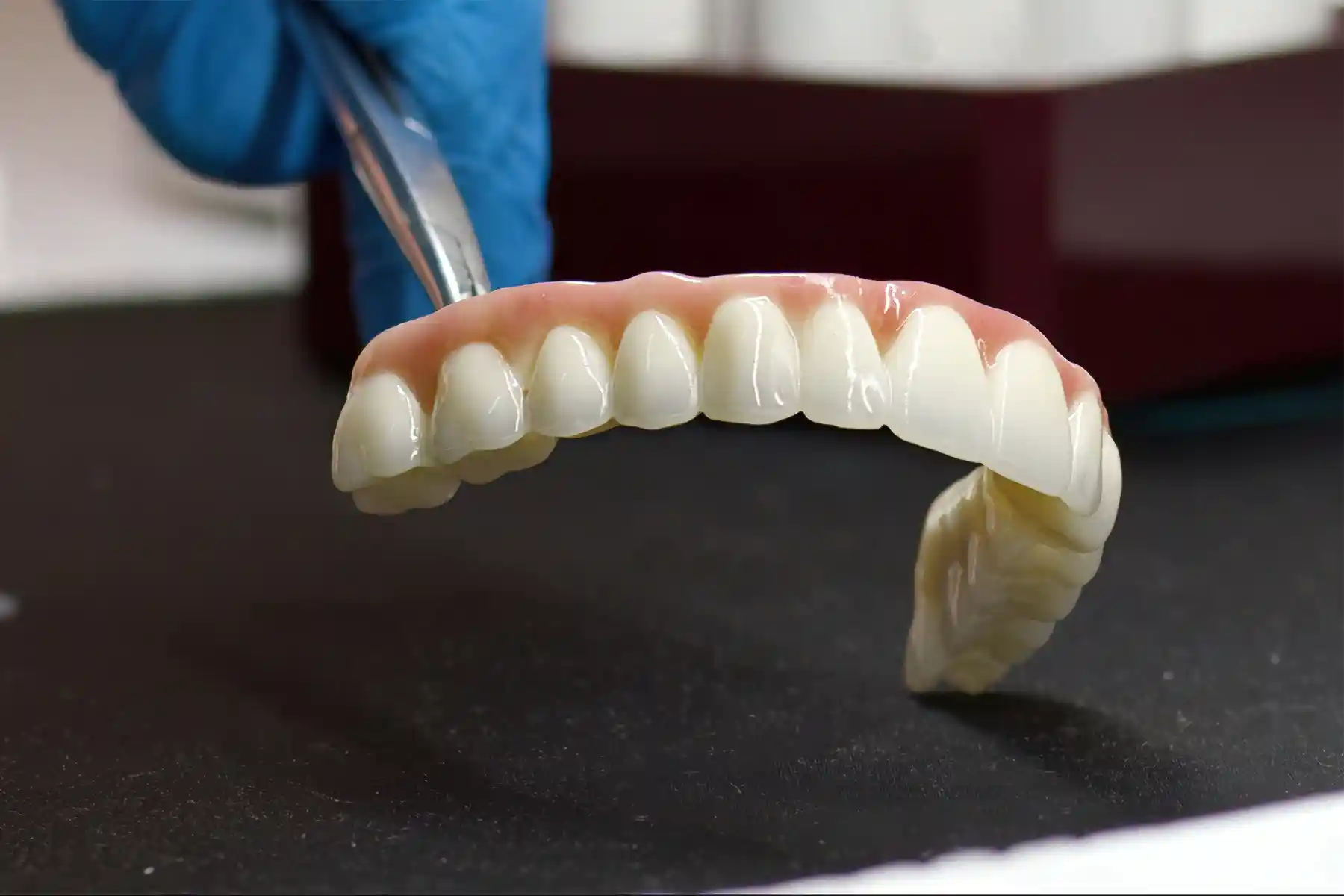 Immediate Dentures After Implants: A Complete Guide to Temporary Teeth and What to Expect
