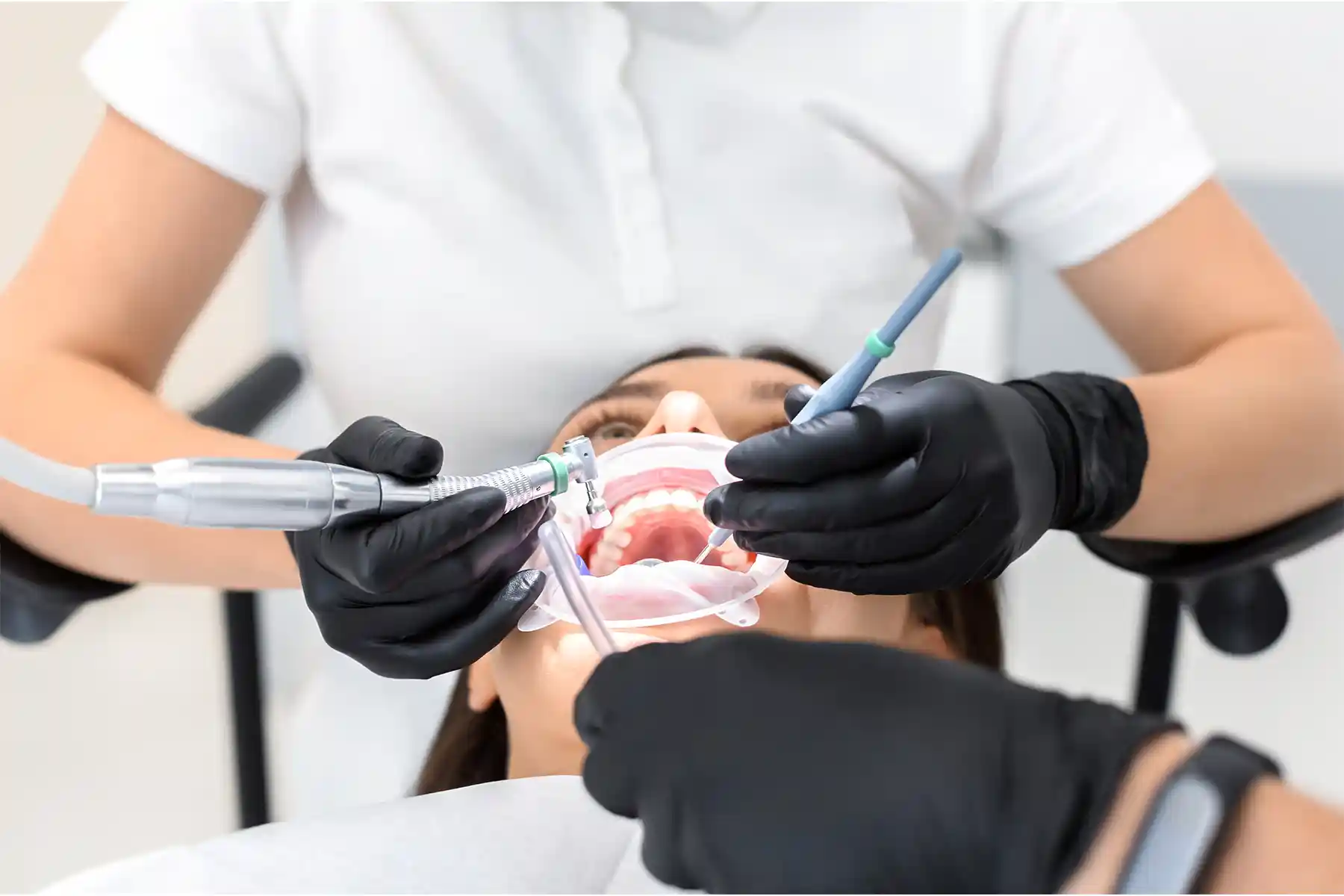 Do You Have to Shave Down Your Teeth for Veneers? What Dentists Really Do