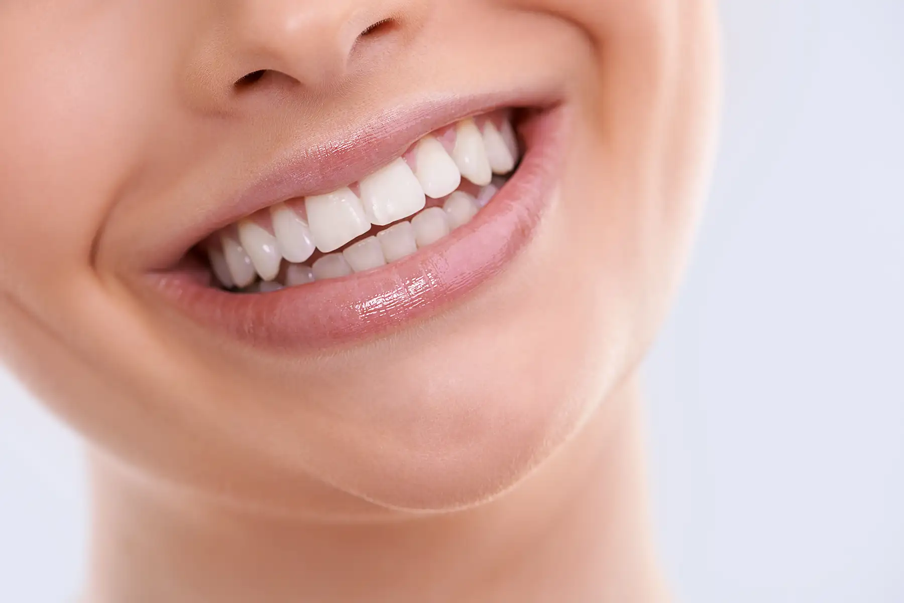 Come ottenere un Hollywood Smile naturale: costi, prezzi in Turchia e risultati reali spiegati