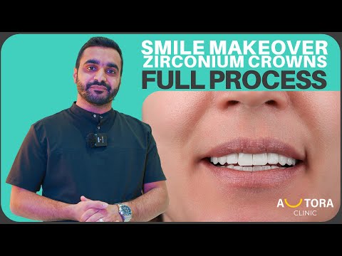 Ultimate Smile Makeover with Zirconium Crowns | Transform Your Smile at Autora Clinic!